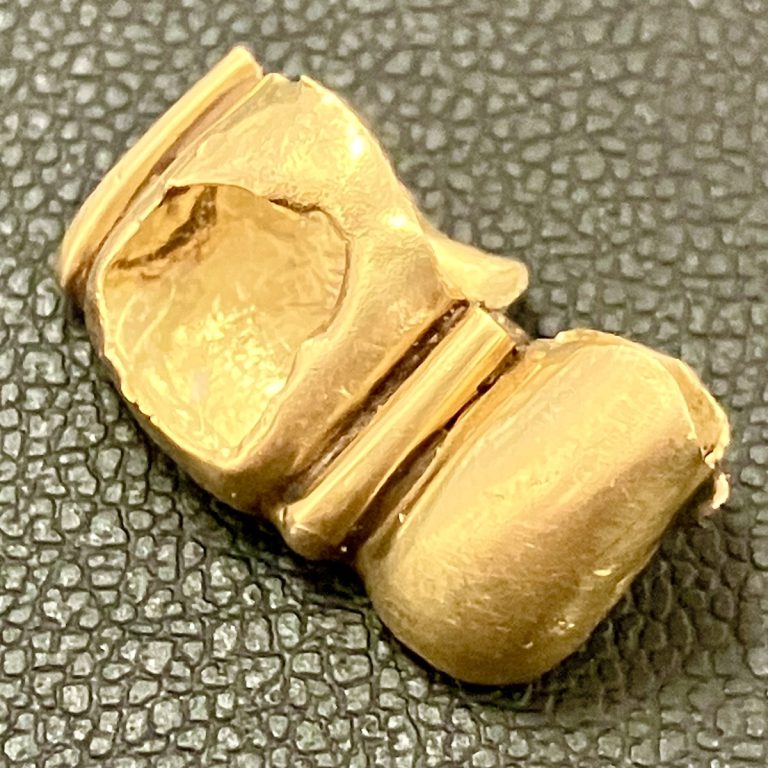 金歯